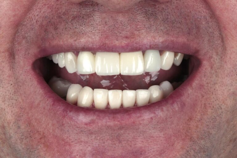 Instagram post from carlosgranadosdental. This post is in position 15.