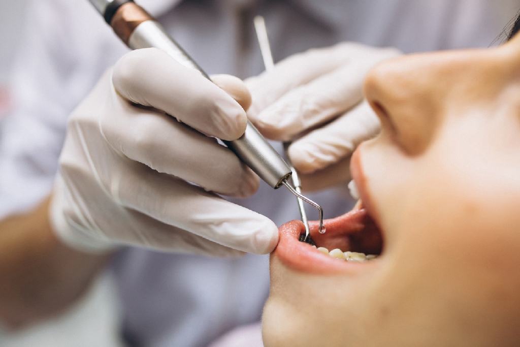 ¿Estética o salud dental? Cuál es el mejor procedimiento odontológico