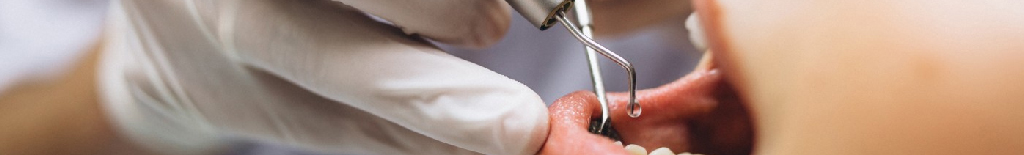 ¿Estética o salud dental? Cuál es el mejor procedimiento odontológico 1 ¿Estética o salud dental? Cuál es el mejor procedimiento odontológico