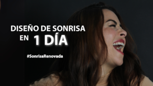 DISENO DE SONRISA